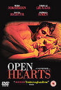 Open Hearts